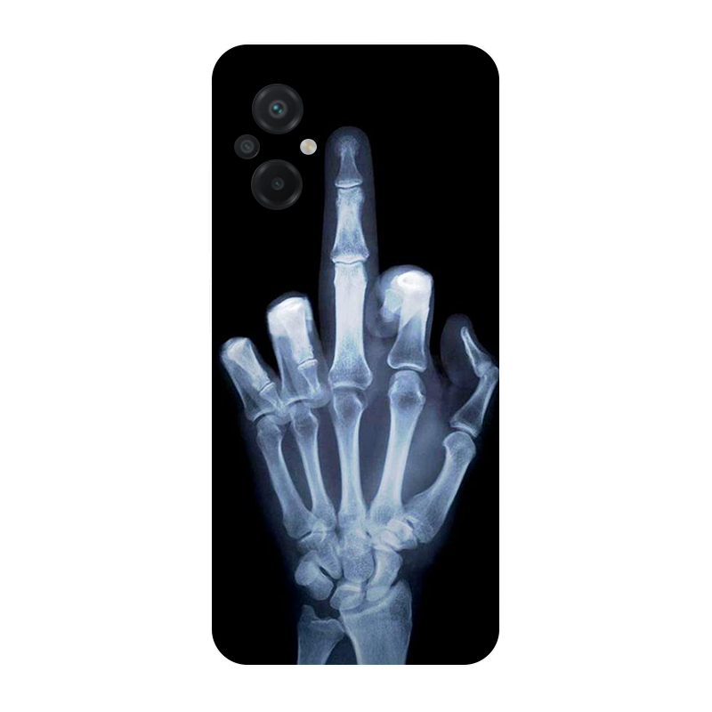 ل Poco M5 2022 4 جرام غلاف كرة - مراجعة Phone Cases Liverpool وسعره